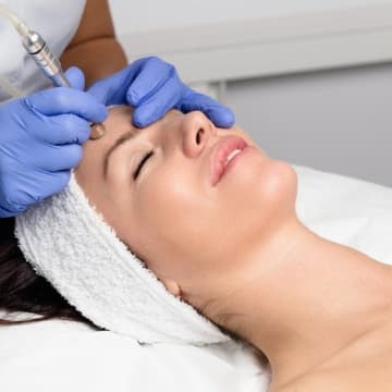 Microdermabrasion at Shimmer Salon Suites in Ocala, FL