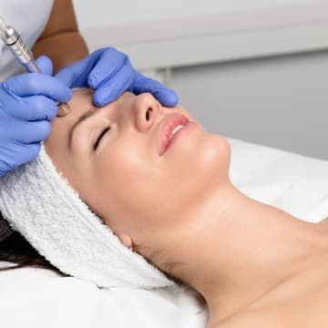Microdermabrasion at Shimmer Salon Suites in Ocala, FL